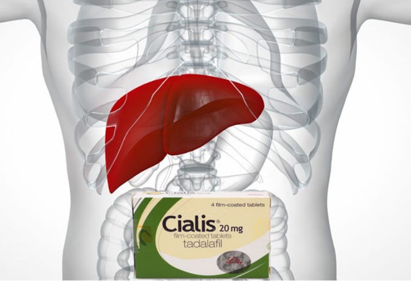 犀利士對肝臟的潛在影響